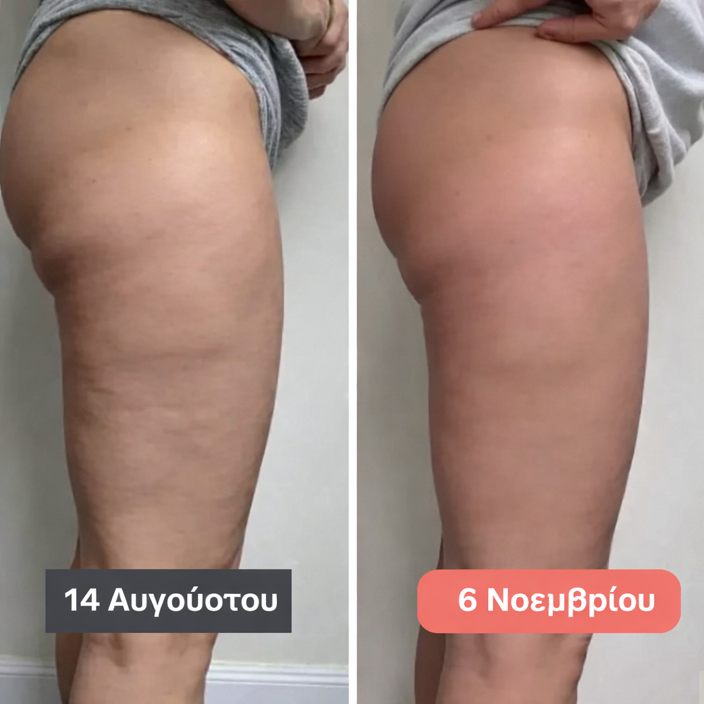 Κολάν 3D Fittabella – Επαναπροσδιόρισε τη σιλουέτα σου χωρίς καμία προσπάθεια.